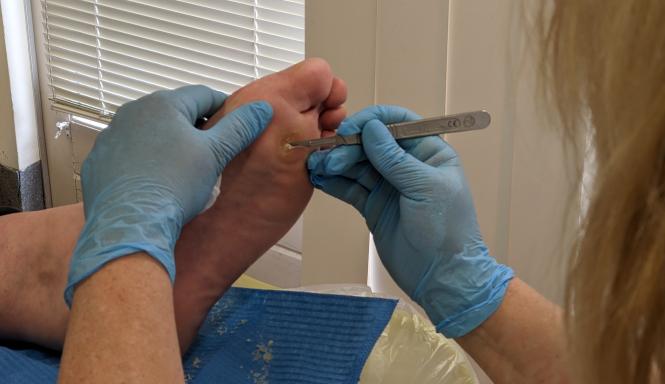 Pedicure aan het werk